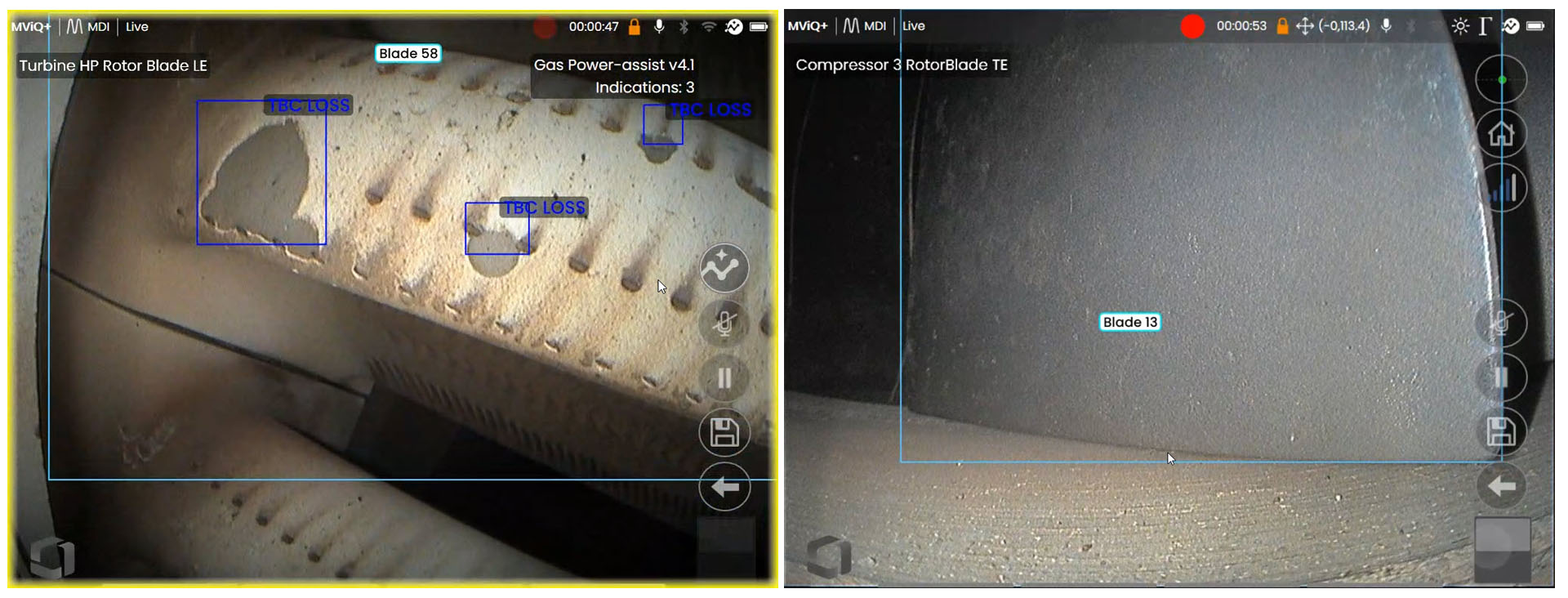 ADR人工智能辅助缺陷识别机叶片智能计数功能