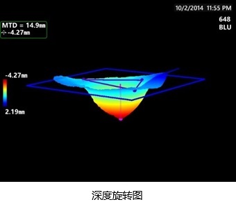 3DPM-深度旋转图